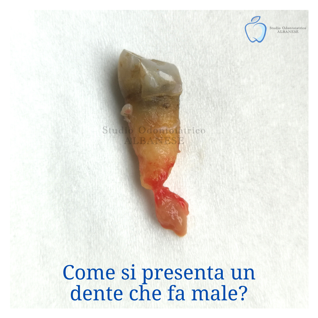 "Come si presenta un dente che fa male? Così." | Studio odontoiatrico